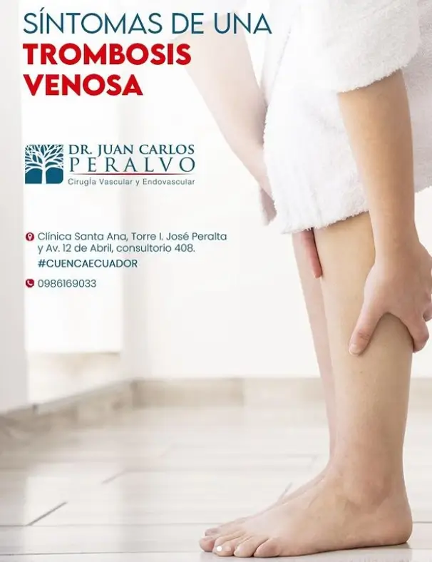 cirugía vascular - Dr. Peralvo en la ciudad de Cuenca. Síntomas de una trombosis