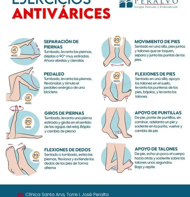Ejercicios Anti-Várices para Mejorar la Salud Vascular