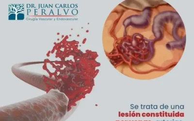 Malformaciones vasculares: Una guía completa