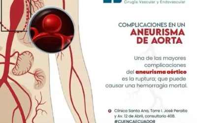 Todo sobre las Complicaciones del Aneurisma Aórtico