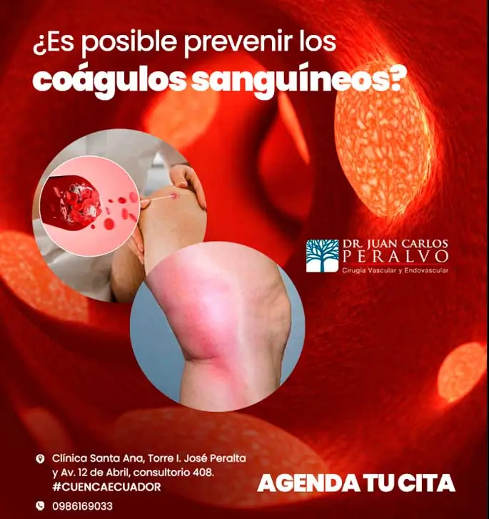 problemas cardiovasculares en la ciudad de cuenca