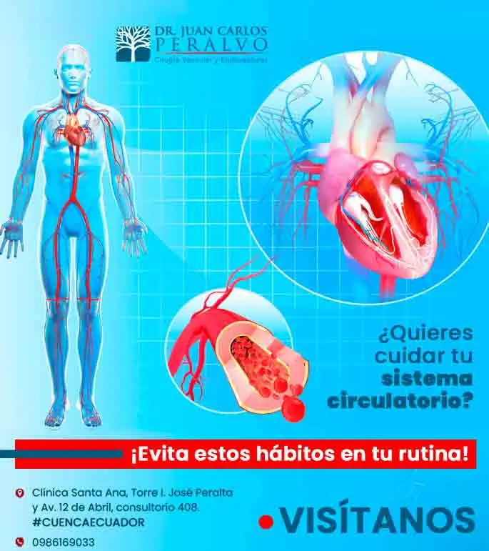 Cirujano vascular en cuenca, cirugía vascular-Ecuador