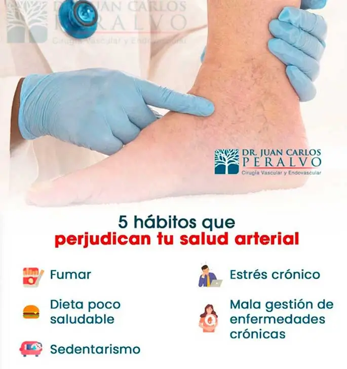 salud arterial, cirujano vascular, cuenca, ecuador