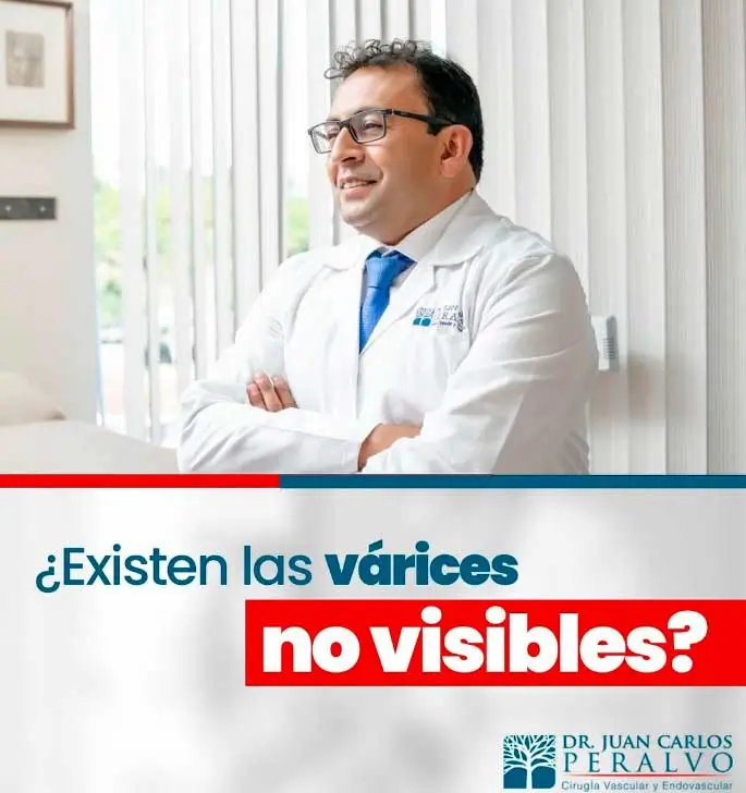 várices internas, dolor en las piernas, insuficiencia venosa, tratamiento para várices internas, Dr. Juan Carlos Peralvo, cirugía vascular