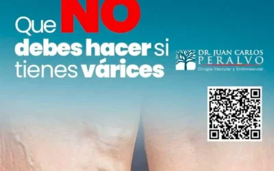 What NOT to Do If You Have Varicose Veins: Common Mistakes to Avoid
