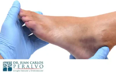 Salud Vascular para Cuidado en el Adulto Mayor