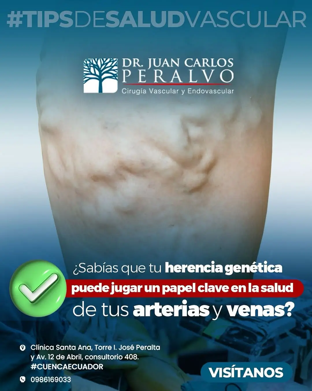 Cirugía Vascular, Varices en Cuenca