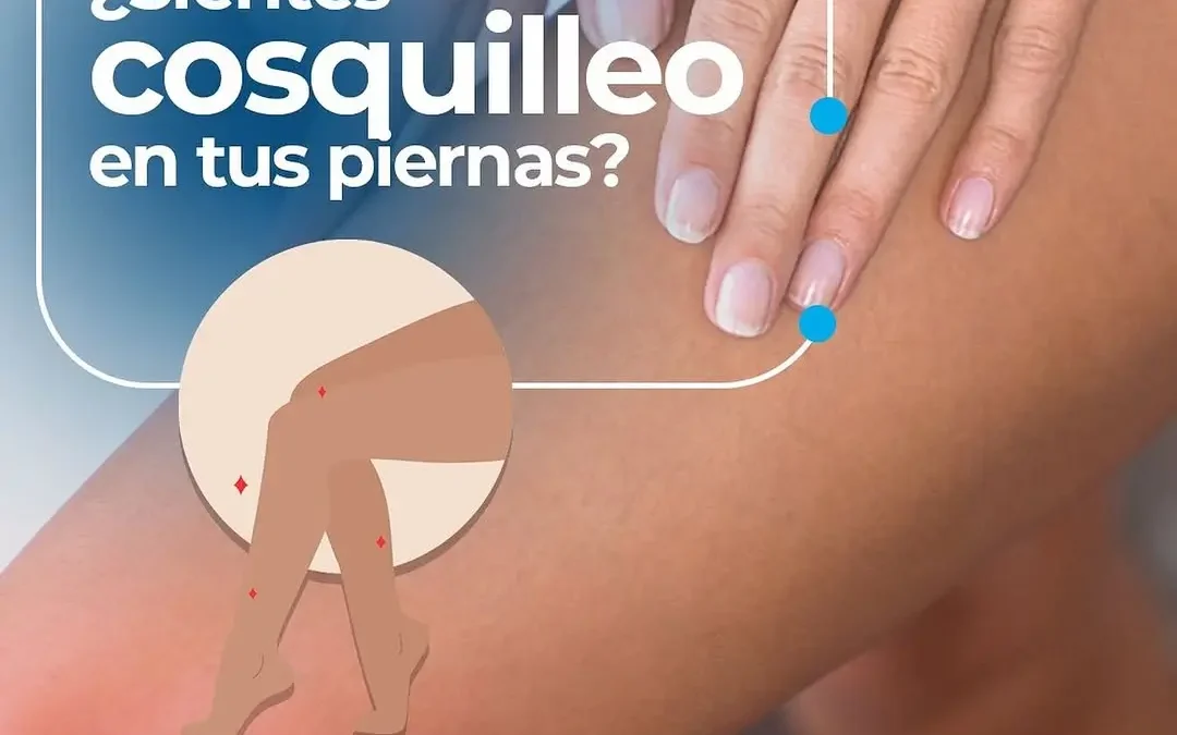 ¿Sientes Cosquilleo en tus Piernas? Conoce las Causas y Soluciones