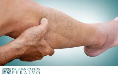Calambres Nocturnos en las Piernas: Causas y Solución