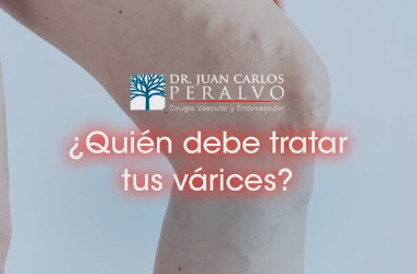 Varicose Vein Treatment in Cuenca: Modern and Effective Options