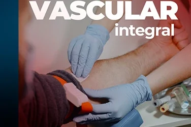 When Was Your Last Vascular Checkup? Discover the Power of Arterial and Venous Doppler