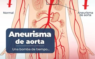 Aortic Aneurysm: The Silent Danger You Need to Know