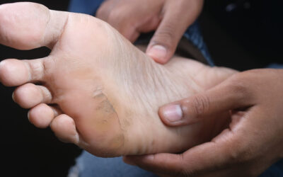 Vascular Surgery in Ecuador: Diagnosis and Treatment of Blood Vessels