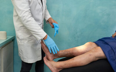 Deep Vein Thrombosis: Risks, Symptoms, and Prevention in Ecuador