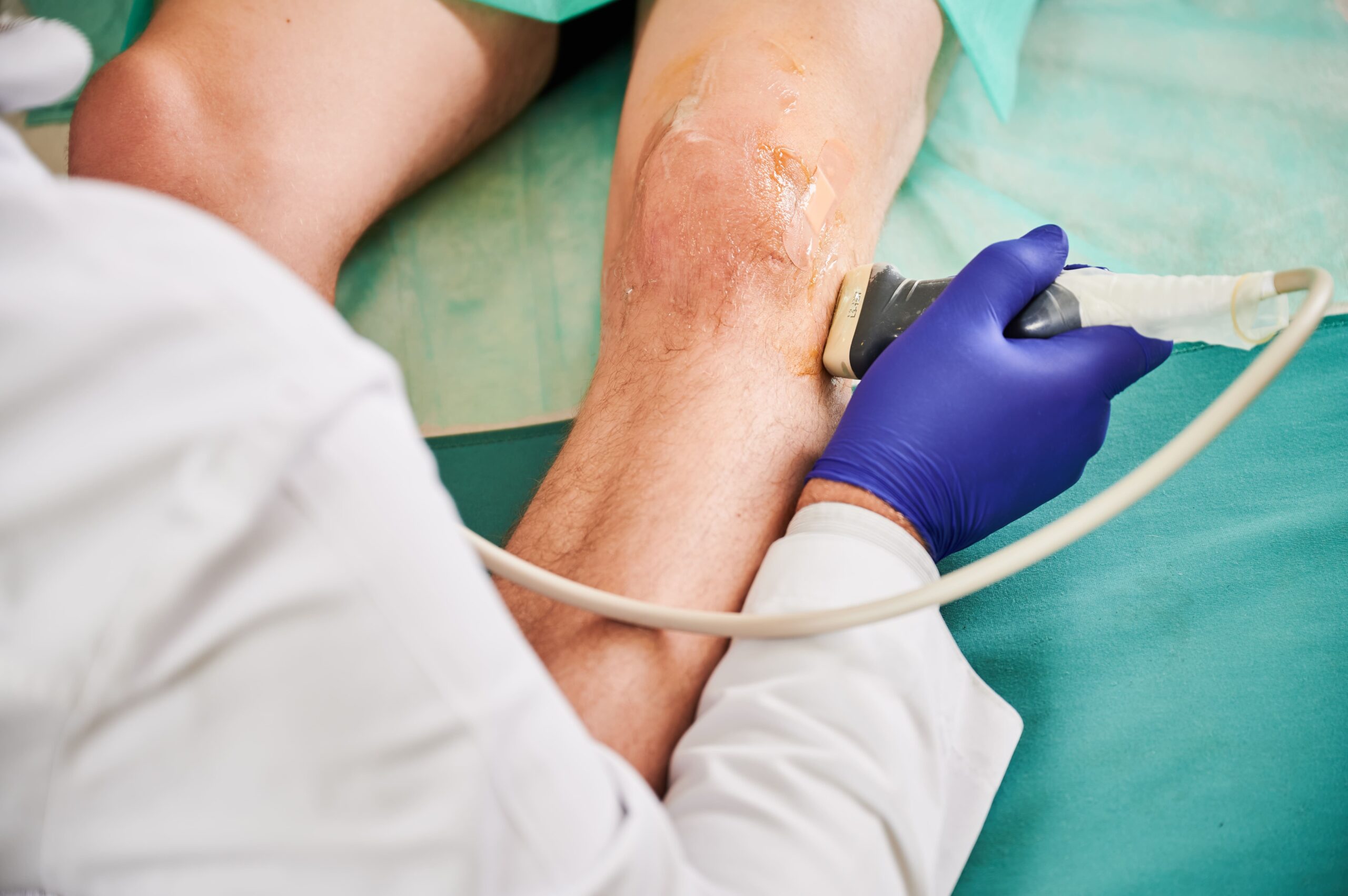 medical-professional-performing-knee-ultrasound-pr-2026-03-17-01-40-00-utc (1) Guía completa sobre insuficiencia venosa crónica en Ecuador